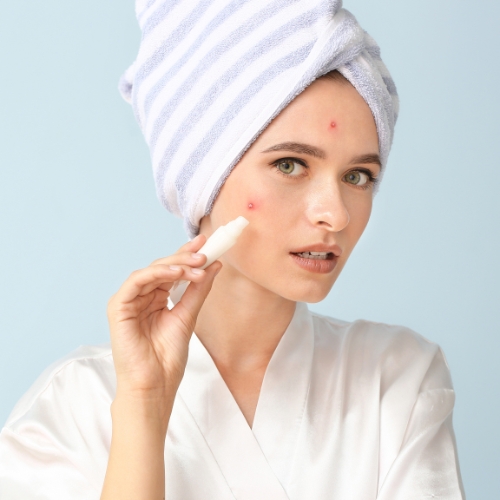 Acne Treatment