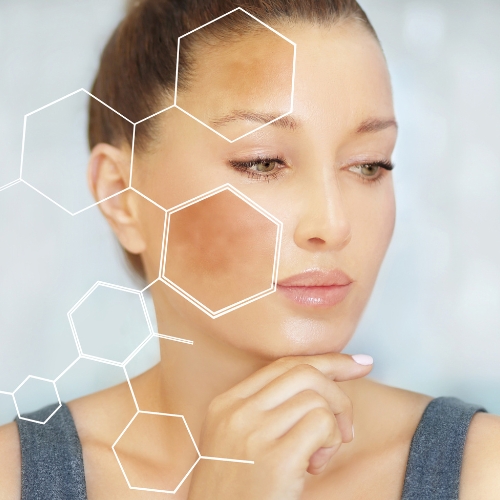 Brown Spot Treatment