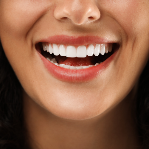 Tooth Contouring